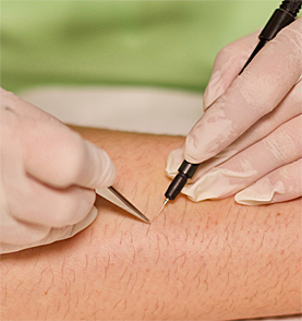 Epilation Patricia Pachaly Epilation Patricia Pachaly